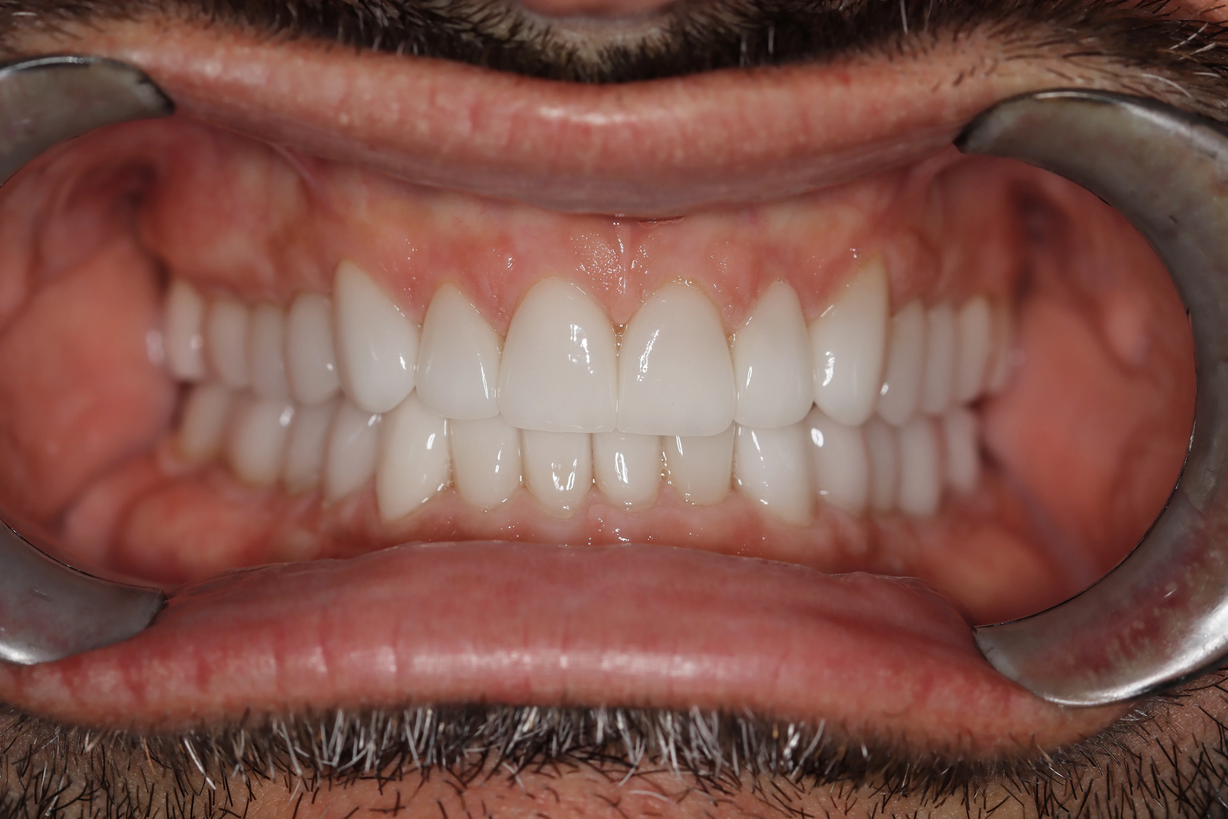 Konig Center for Cosmetic & Comprehensive Dentistry smile photos