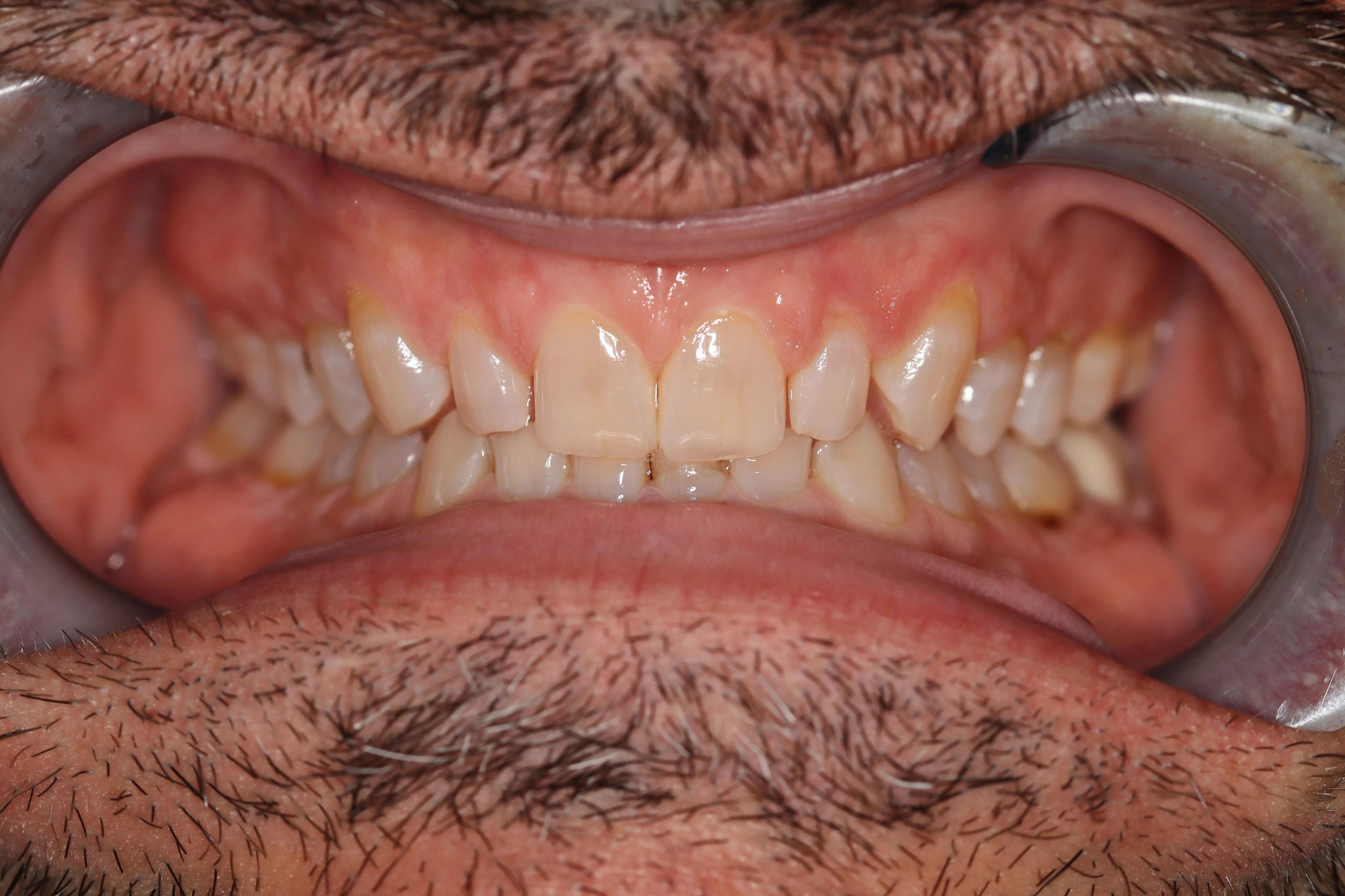 Konig Center for Cosmetic & Comprehensive Dentistry smile photos