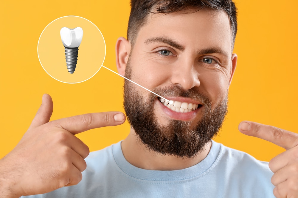 A man smiling and pointing to his teeth, where dental implants have been placed